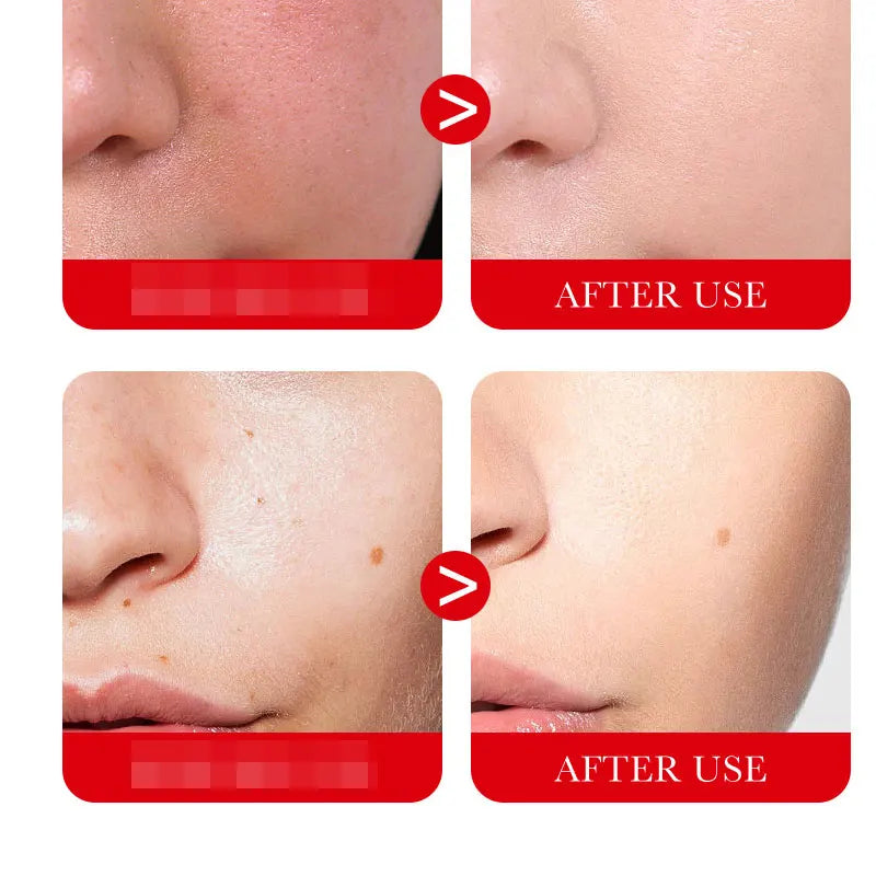 Ceramide Repair Serum Is Specially Designed for Sensitive Skin Repair Damaged Skin Firming and Anti-aging Facial Care Serum