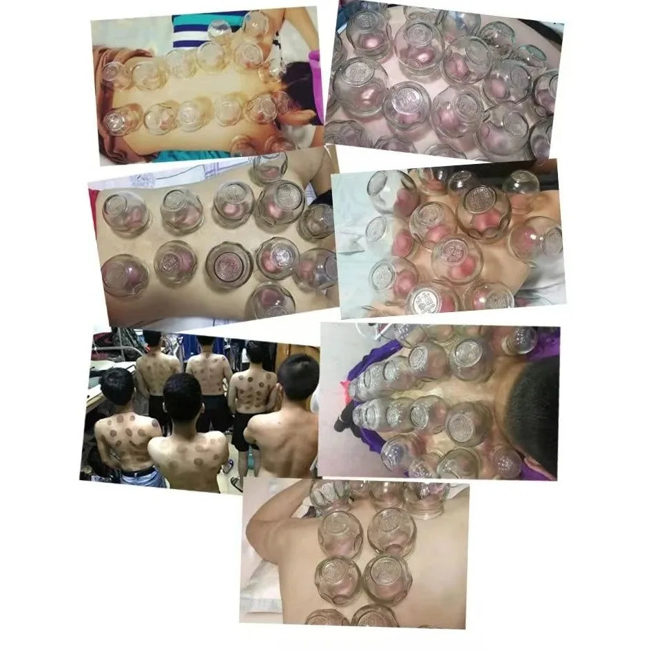 6 Pcs Gua Sha Therapy Cans Body Set Chinese Set Glass Fire Can Hand Tools Appliance Thickened Cupping Cup Massager Scraping Cups