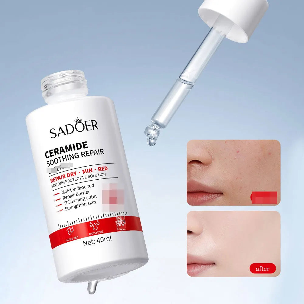 Ceramide Repair Serum Is Specially Designed for Sensitive Skin Repair Damaged Skin Firming and Anti-aging Facial Care Serum