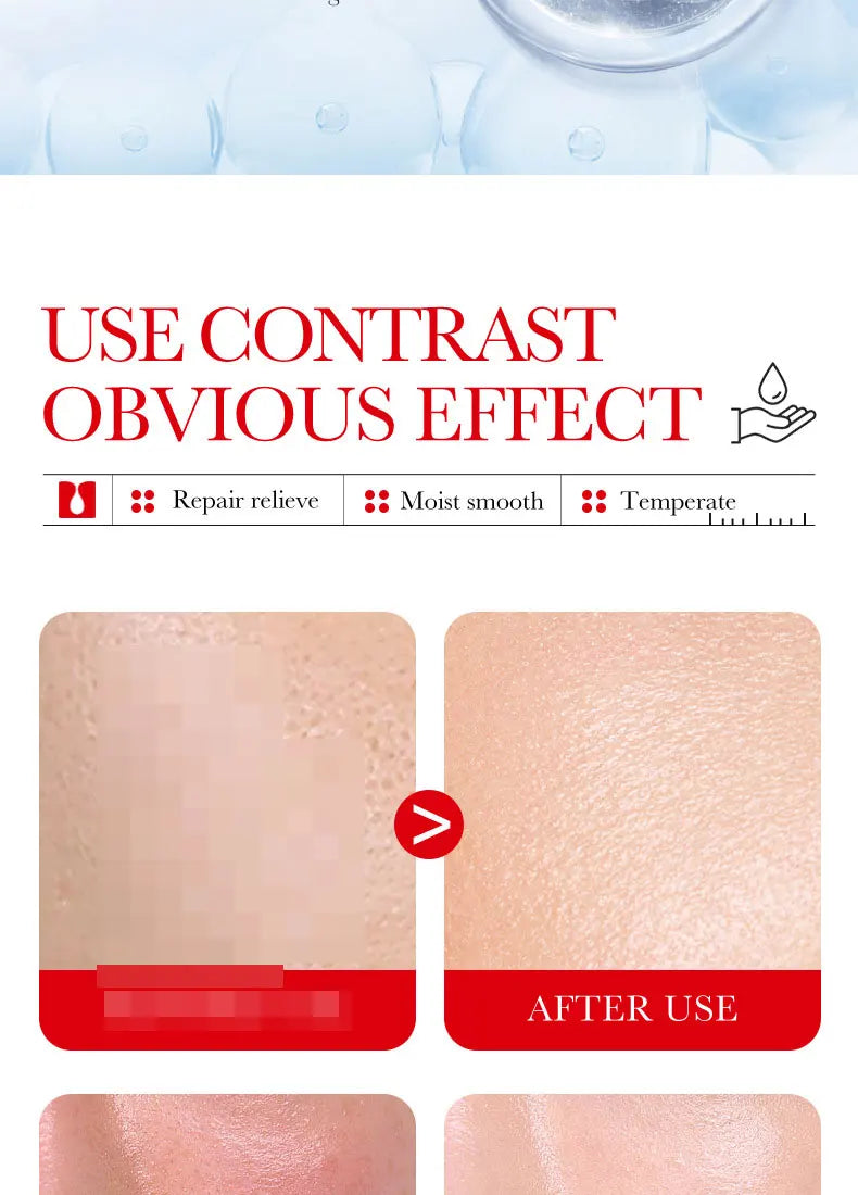 Ceramide Repair Serum Is Specially Designed for Sensitive Skin Repair Damaged Skin Firming and Anti-aging Facial Care Serum