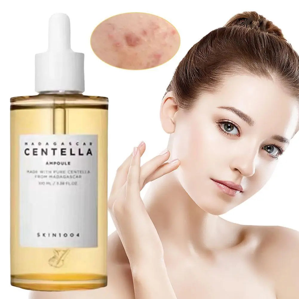 Original Centella Toner Serum Centella Asiatica Ampoule Essence Moisturize For All Skin types Acne Remove Face Care Serm Care