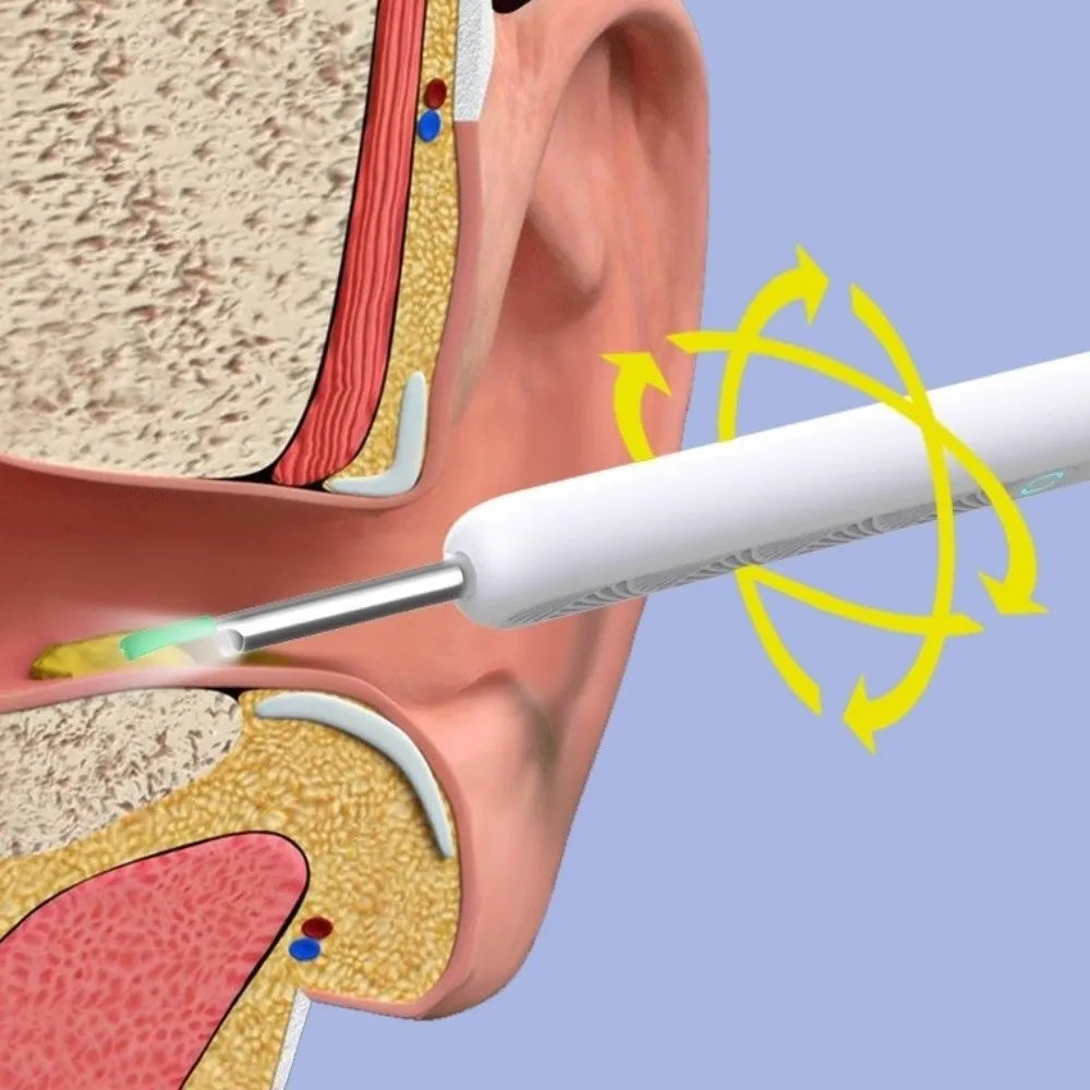Smart Visual Ear Cleaner Wireless WiFi HD Camera Wireless Otoscope USB Charging LED Lights Ear Cleaning Tools Oral Inspection