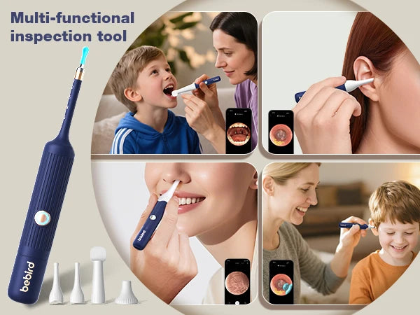 Smart Visual Ear Wax Upgraded Cleaner With Camera 800W HD Endoscope Brighter Clearer Clarity Ear Cleaning Tool Includes Storage