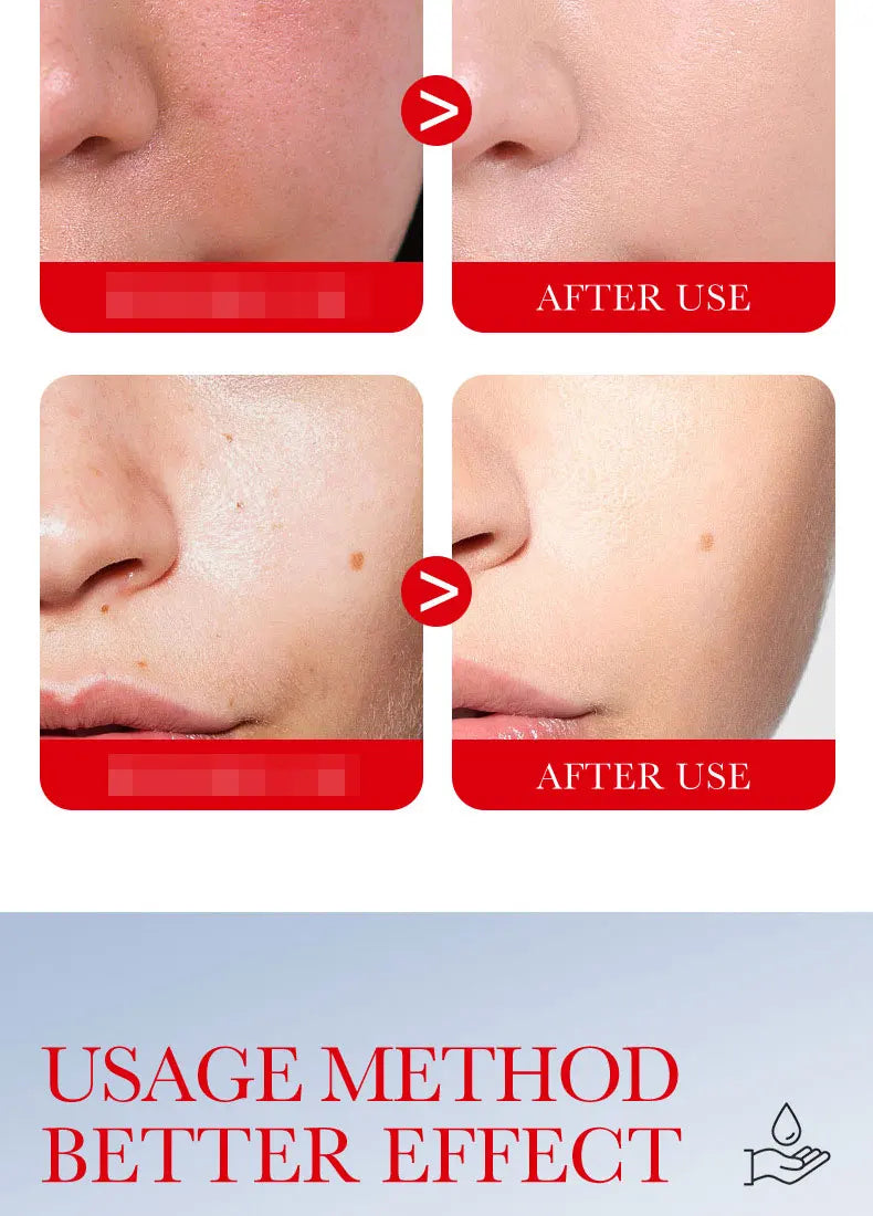 Ceramide Repair Serum Is Specially Designed for Sensitive Skin Repair Damaged Skin Firming and Anti-aging Facial Care Serum