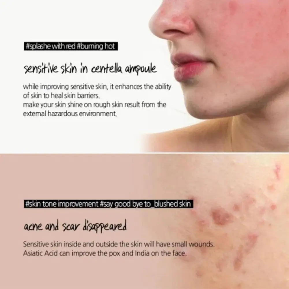 Original Centella Toner Serum Centella Asiatica Ampoule Essence Moisturize For All Skin types Acne Remove Face Care Serm Care