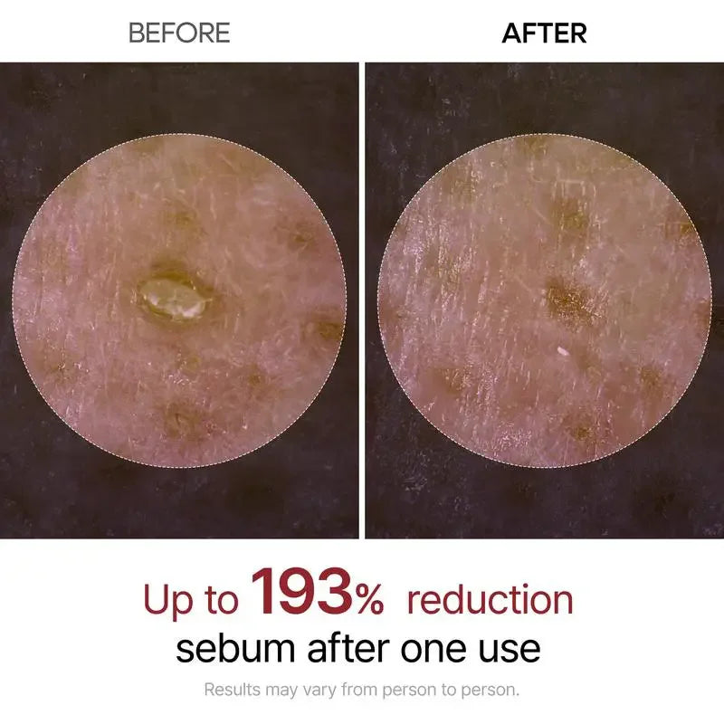 Peel Shot Glow Rice Ampoule Serums for Brightening, Exfoliating, and Moisturizing - Suitable for All Skin Types